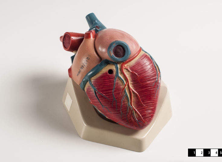 Living Heart Project develops ‘walk-in’ heart simulation to aid research
