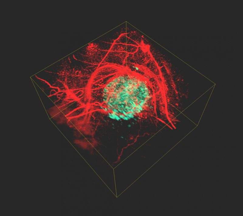 Lasers able to produce 3D images of cancer cells