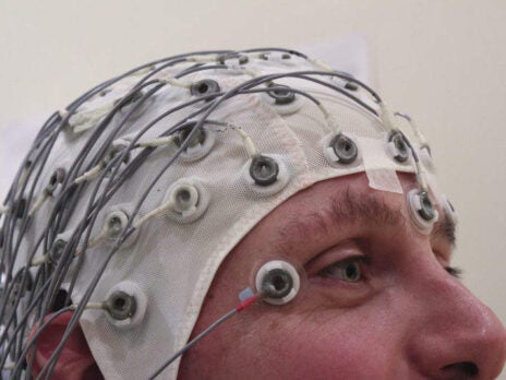 Can EEG effectively predict Autism onset?