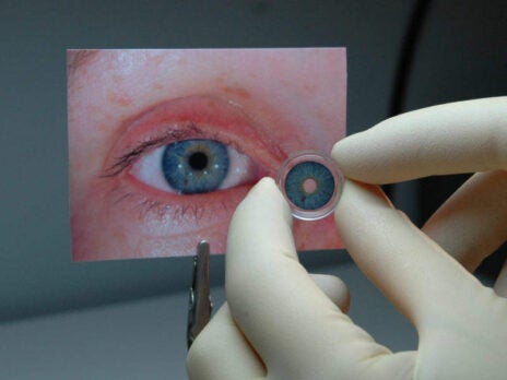First artificial iris provides a novel method for treating iris defects