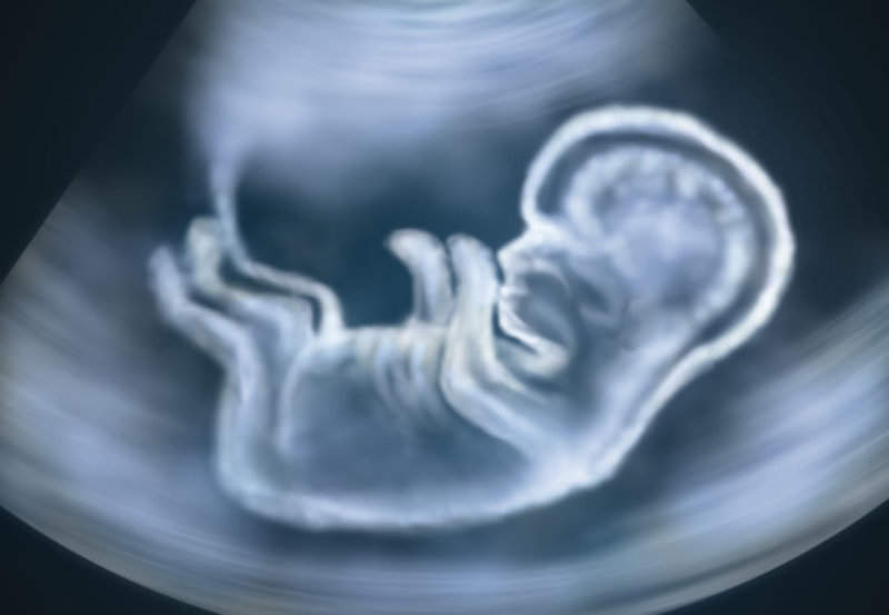 monitor foetal movements