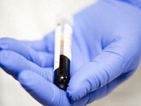 Blood test can help detect kidney cancer five years early