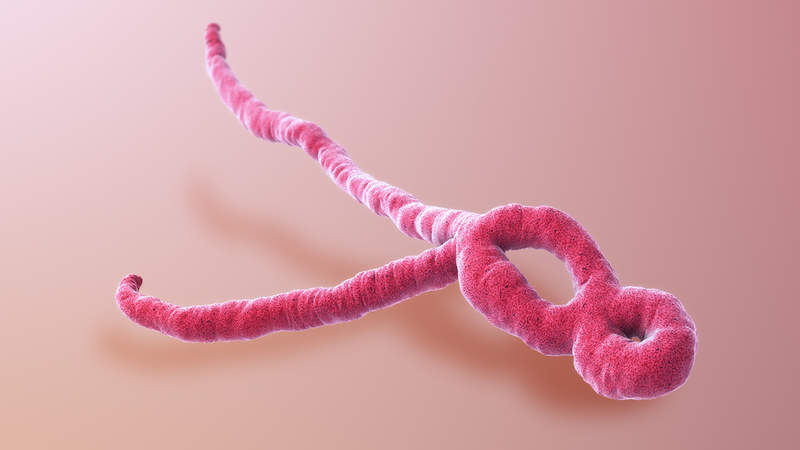 Chembio Ebola virus test