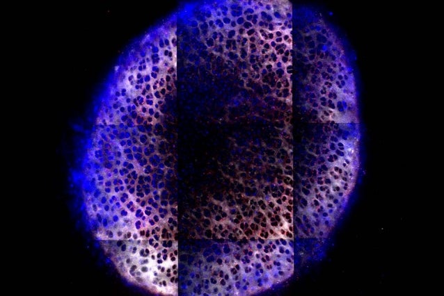 Cartilage regeneration new nanomaterial