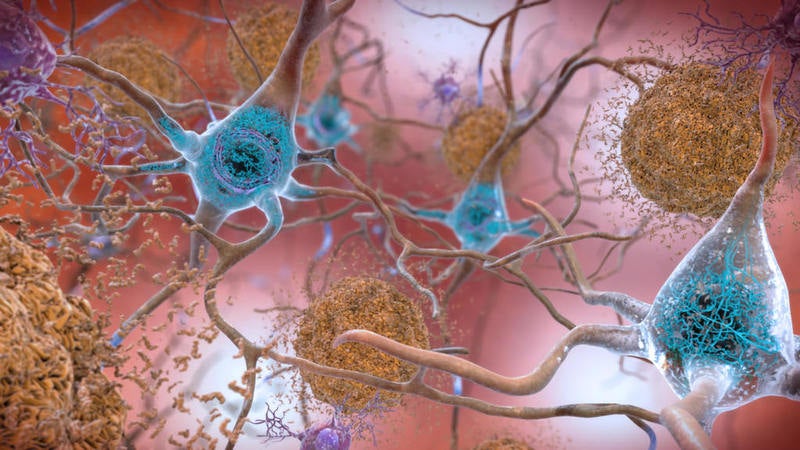 C2N Diagnostics’ Alzheimer’s test gets FDA breakthrough status