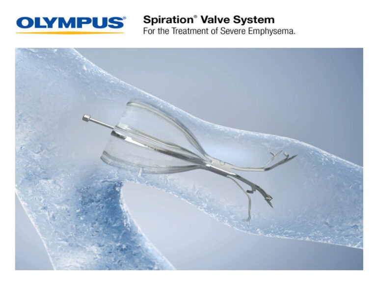 Olympus Launches New Spiration Valve To Treat Severe Emphysema