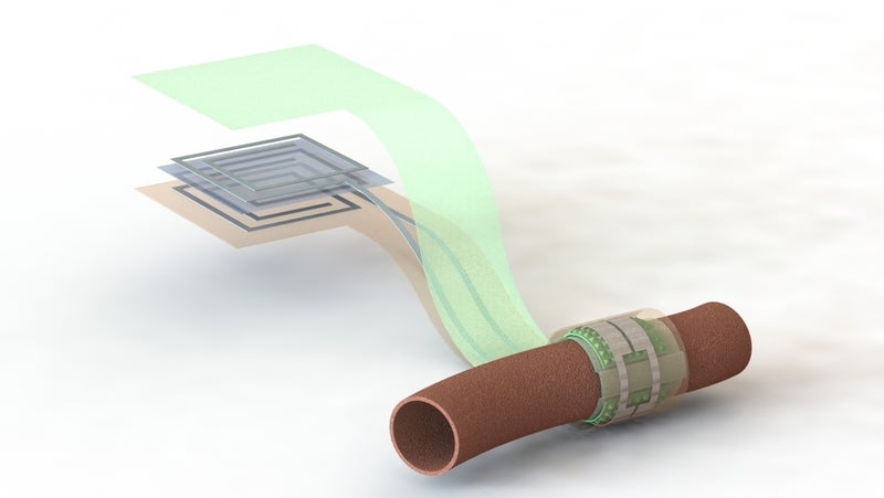 Biodegradable blood flow sensor