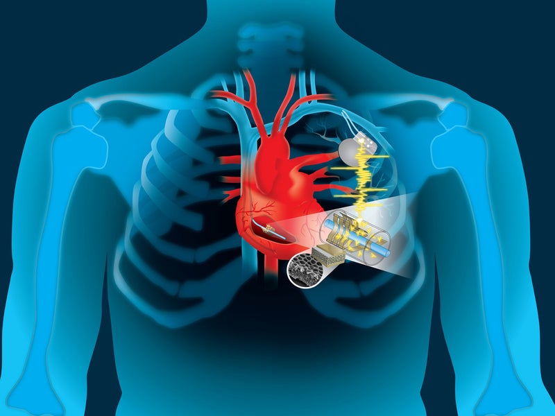 US researchers power medical implants with heart’s energy