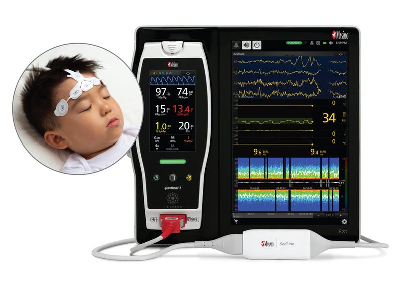 Masimo gets CE-Mark for SedLine monitoring in paediatric patients