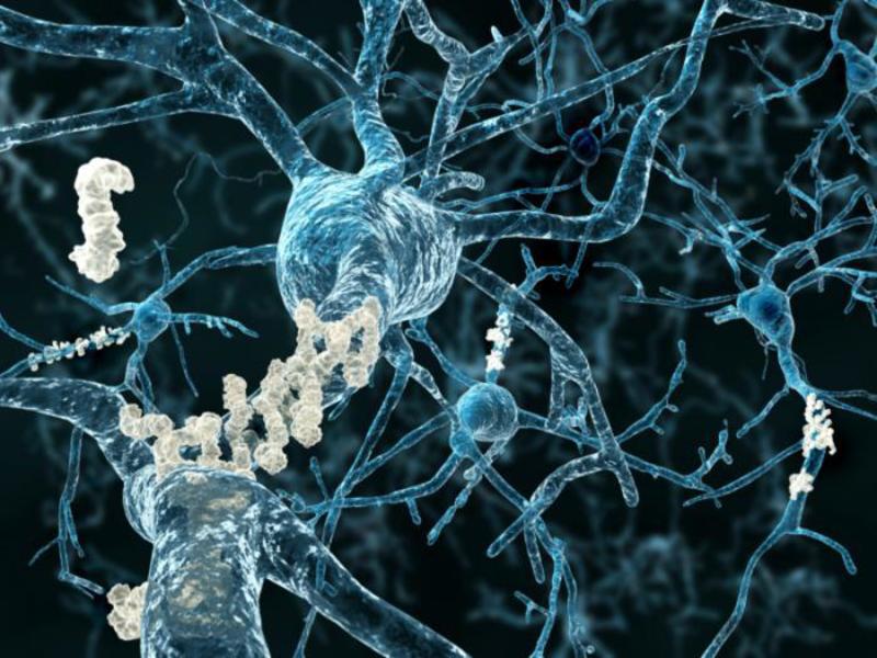 IBM new research leverages AI to predict Alzheimer’s