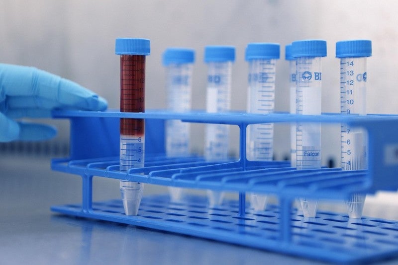 Study assesses blood test to match patients to clinical trials