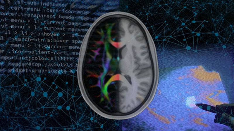 US report offers roadmap for research on AI in medical imaging