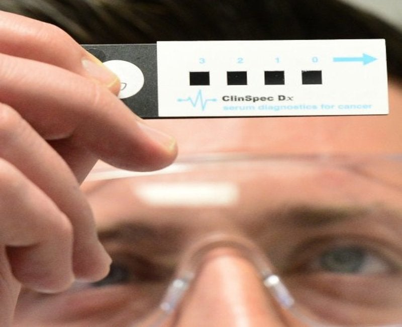 ClinSpec Diagnostics develops brain cancer detection test