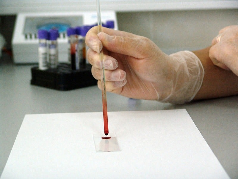 DNA analysis from blood