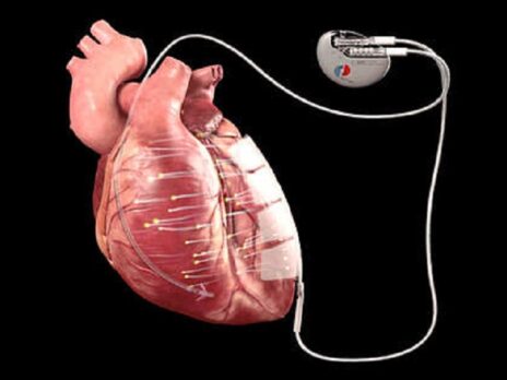 New implant uses microcurrent to strengthen heart muscle