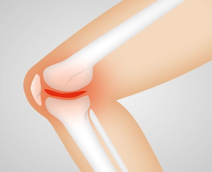 UK scientists create mini MRI scanner to detect knee injuries