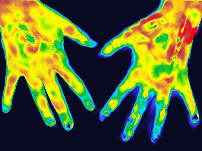 infrared arthritis
