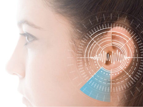 Astellas Pharma and Frequency Therapeutics collaborate on hearing loss therapy