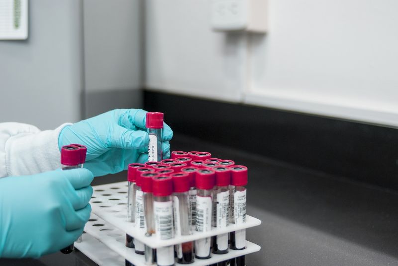 New discovery facilitates blood test for mortality risk in elderly