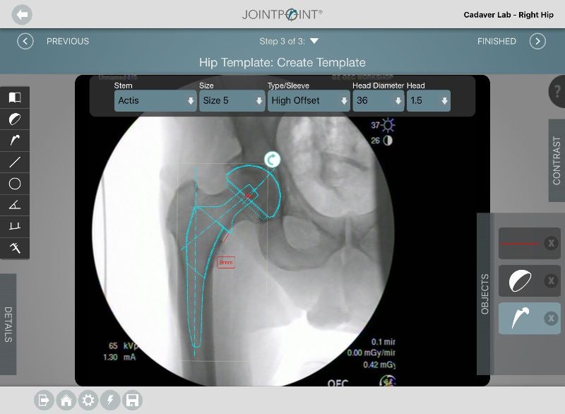 DePuy Synthes to buy JointPoint software