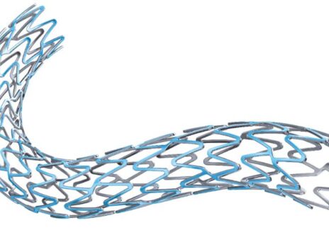Boston Scientific reports positive trial data for Synergy stent