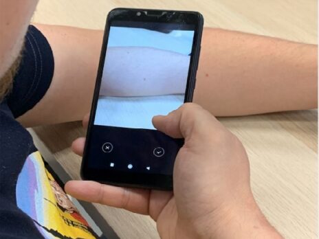 DataArt launches SkinCareAI app to detect early melanoma signs