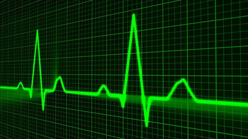 Eko secures funds to develop AI tool for cardiac screening