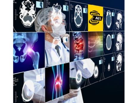 Zebra Medical Vision and DePuy Synthes to bring AI to orthopaedic care
