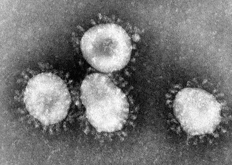 Primerdesign launches molecular test for new coronavirus