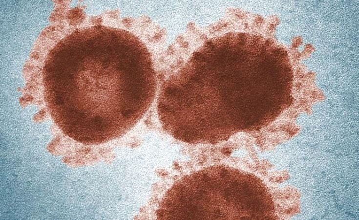 IDbyDNA’s Explify Respiratory Test can detect coronavirus