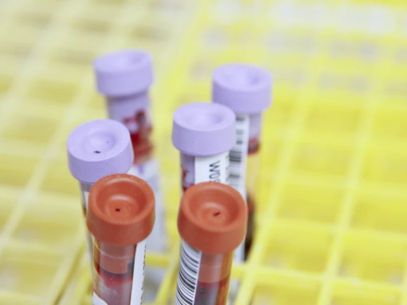 BD and BioMedomics roll out blood test to detect Covid-19 exposure