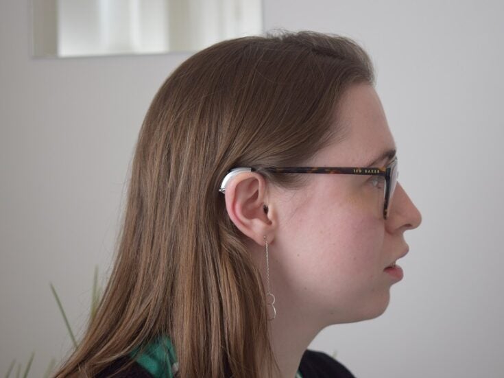 ‘Healthable’ hearing aids: empowering young people with hearing loss