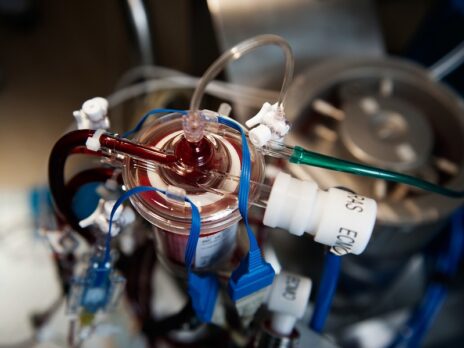 Extracorporeal organs could save the sickest patients from Covid-19
