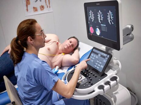 Philips bolsters cardiovascular ultrasound portfolio with Affiniti CVx launch