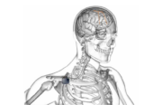 Medical devices in-depth product overview: deep brain stimulation systems
