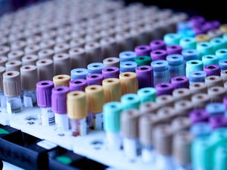 Eurofins introduces SARS-CoV-2 Direct RT-PCR test