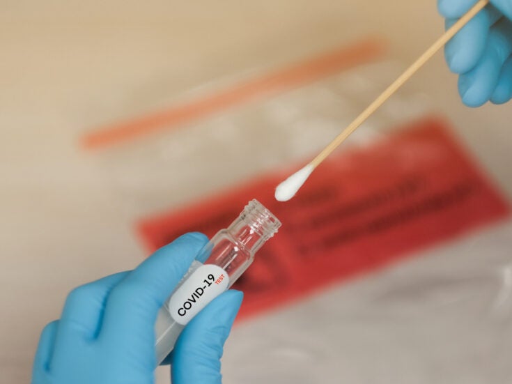 LabCorp unveils new antigen test for Covid-19