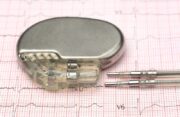 Medical device in-depth product overview: Pacemaker leads