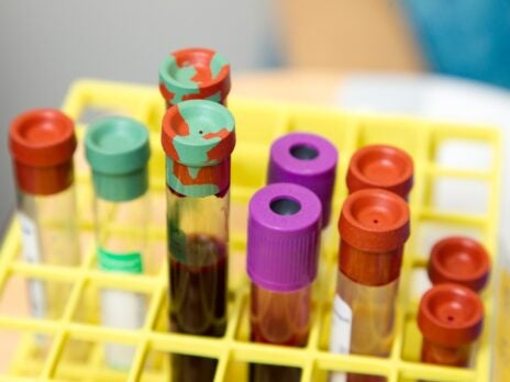 Start-up Tzar Labs develops blood test for cancer detection