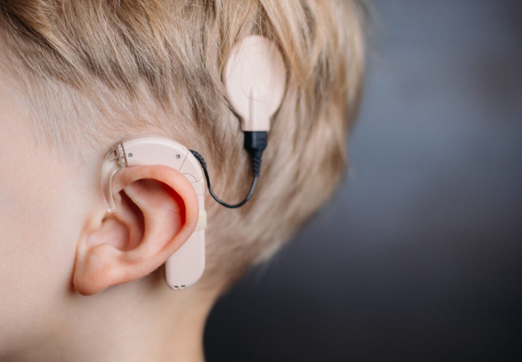 audism cochlear implants
