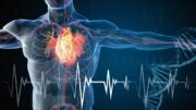 Medical devices in-depth overview: hemodynamic monitoring to prevent heart failure