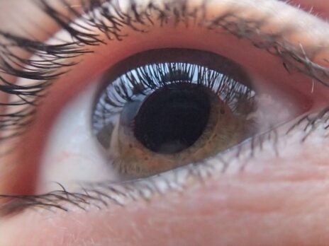 Flinders University develops genetic test for glaucoma