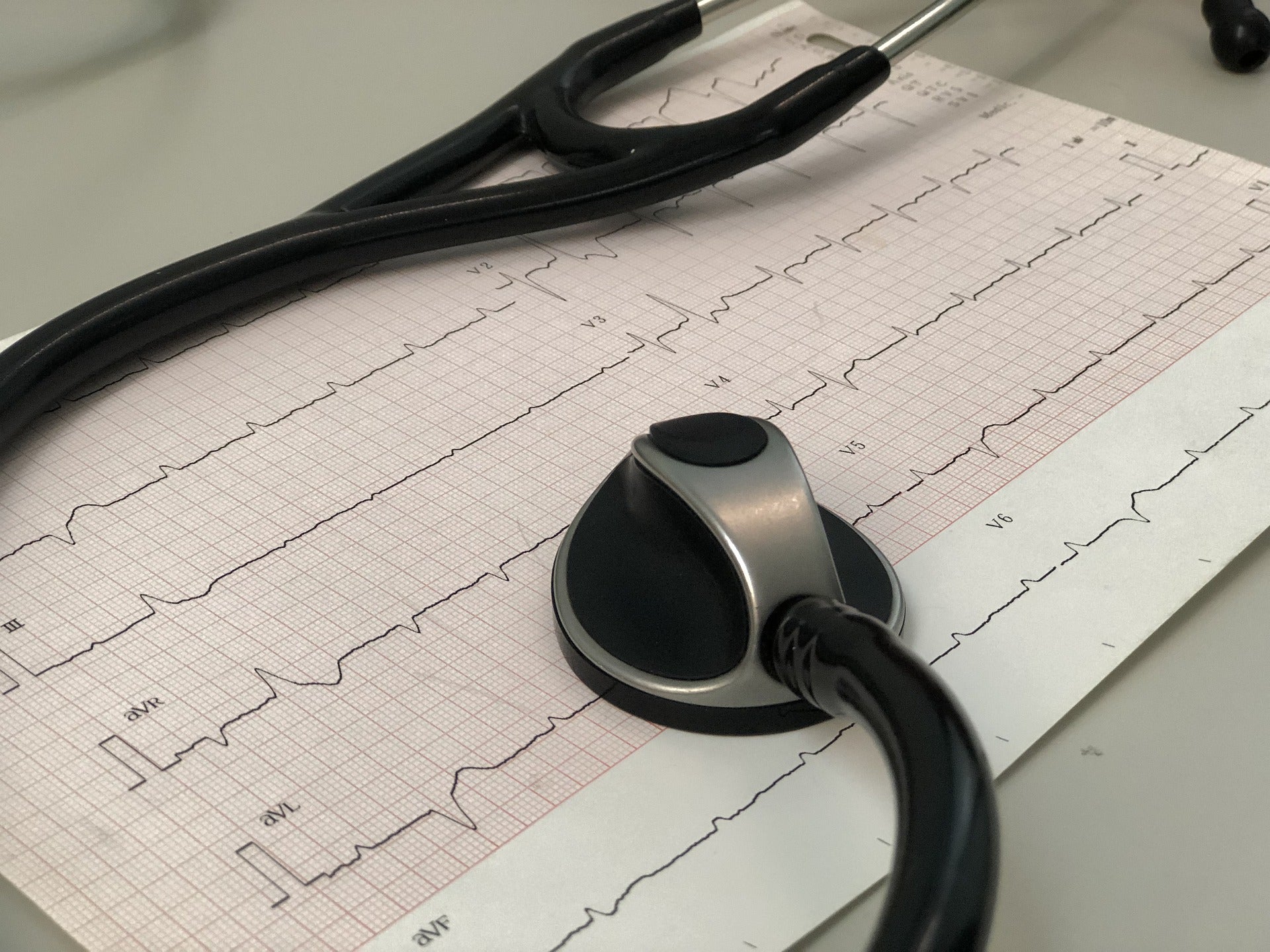 AliveCor® KardiaMobile EKG Monitor - FDA-Cleared 