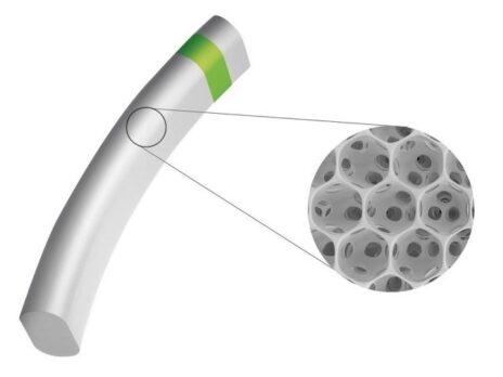 iSTAR Medical gets FDA nod to initiate trial of MINIject for glaucoma 
