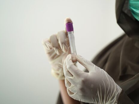 Stockholm3 blood test improves prostate cancer screening, study finds