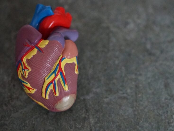 Abbott's CardioMEMS system lowers mortality in heart failure patients