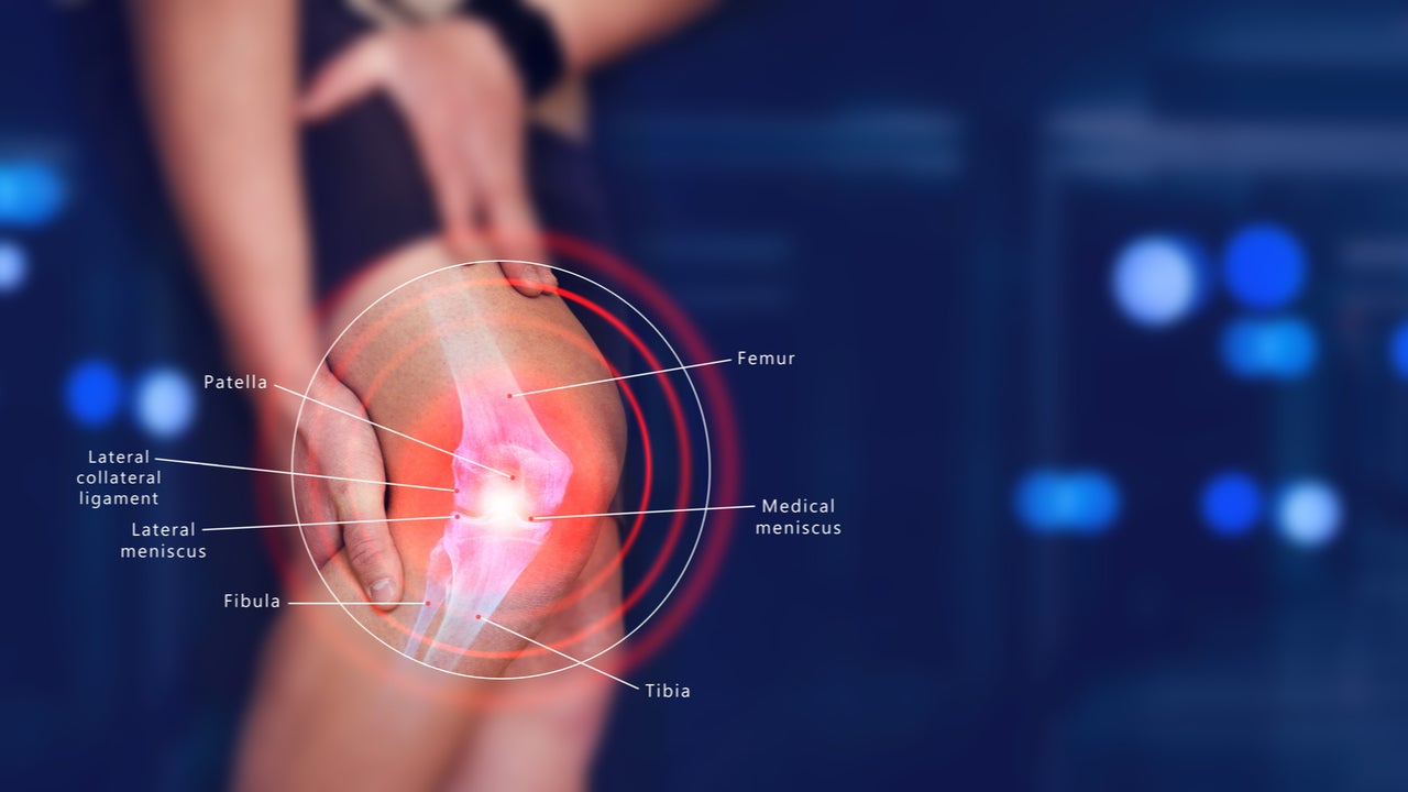 Survey of chronic pain in Chile – prevalence and treatment, impact