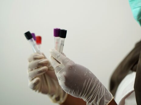 CoSara’s Saraplex RT-PCR test receives Indian regulator approval
