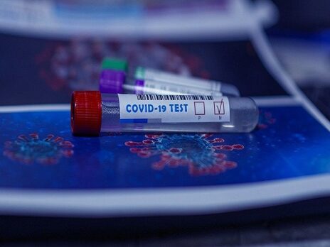 Eurobio Scientific introduces new Covid-19 RT-PCR test