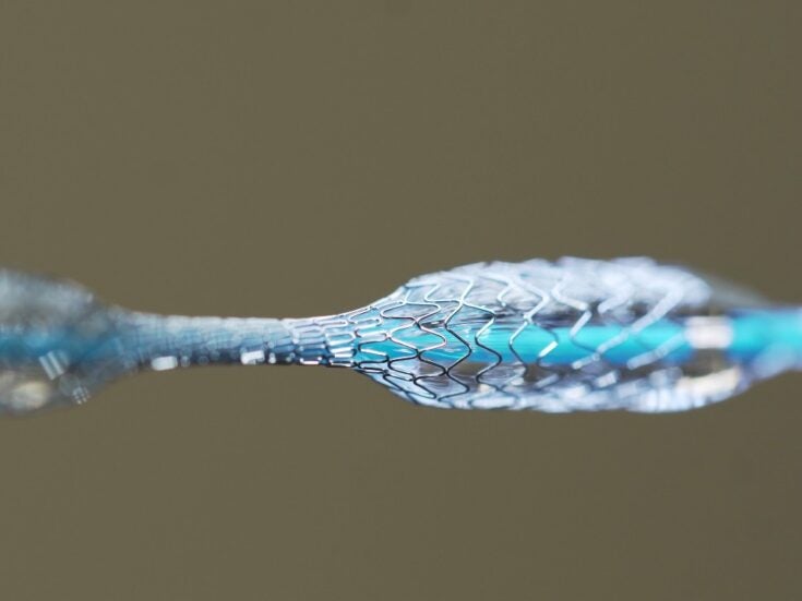 Photo of The superelastic alloy: How nitinol opened the doors for innovative medical device design